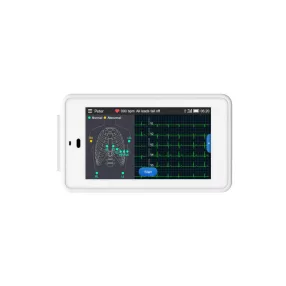   Viatom ECG-500 6-12 elvezetéses zseb EKG készülék (ECG-500)