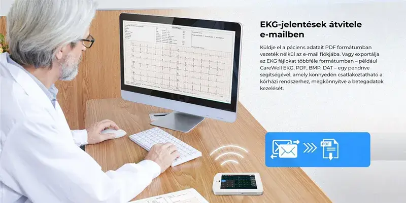 viatom-ecg-500-6-12-elvezeteses-zseb-ekg-keszulek-jelentesek