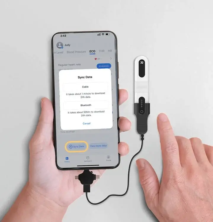 viatom-er1-lb-24-oras-ekg-holter-rogzito-mobil-ekg-holter-adatatvitel