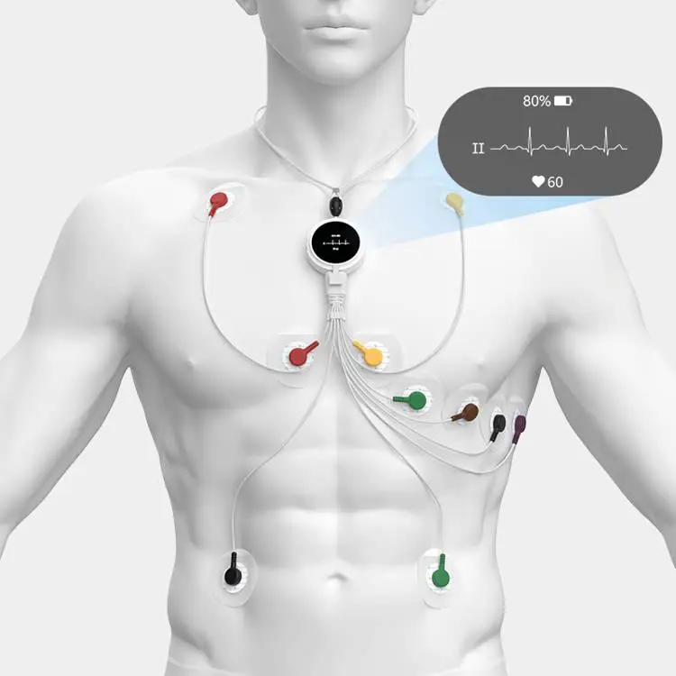 viatom-lepod-pro-er3-12-elvezeteses-24-oras-mini-ekg-holter-monitor-12-elvezetes