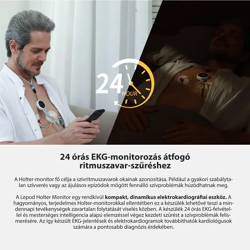 viatom-lepod-pro-er3-12-elvezeteses-24-oras-mini-ekg-holter-monitor-atfogo-ritmuszavar-szures