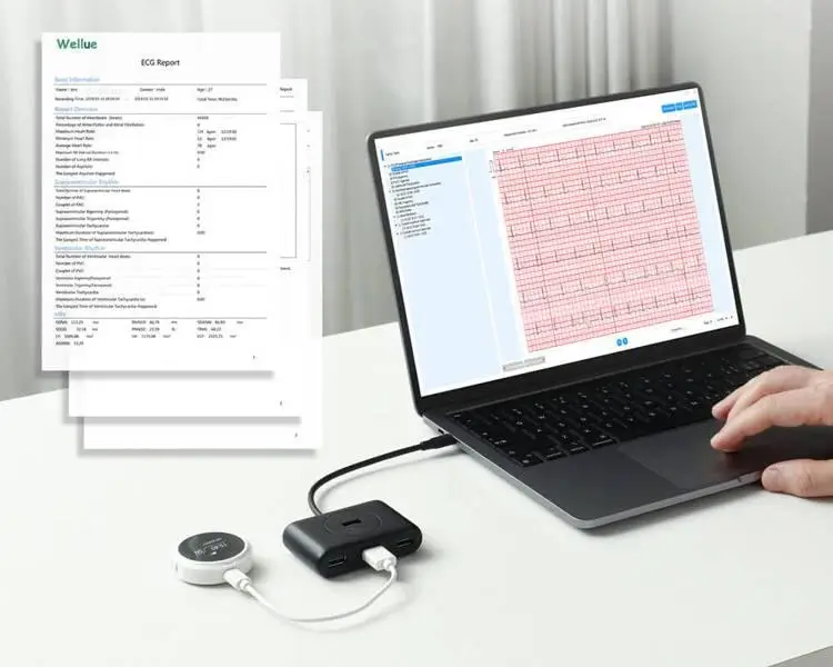 viatom-lepod-pro-er3-12-elvezeteses-24-oras-mini-ekg-holter-monitor-csatlakoztatas