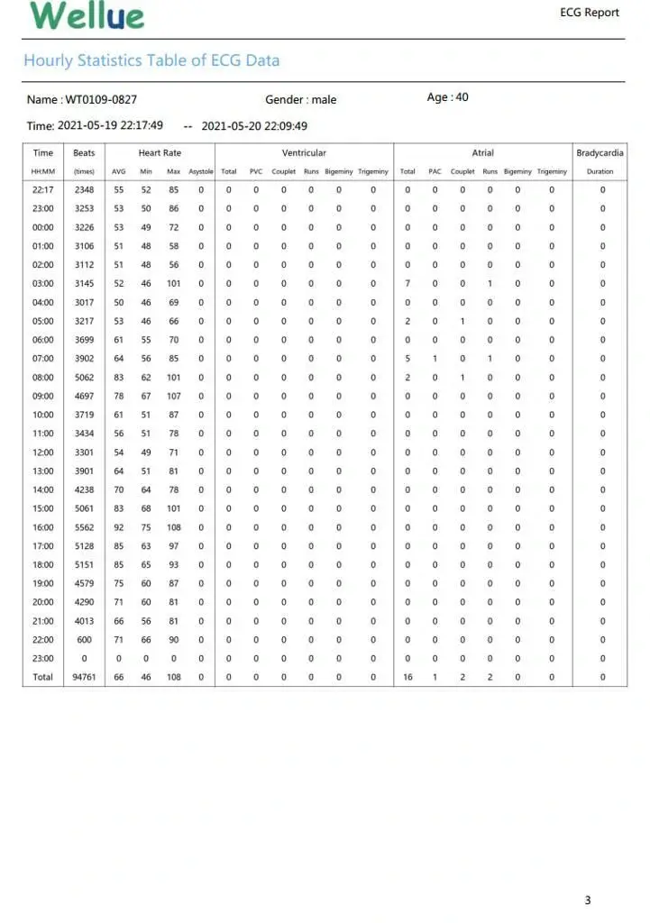 viatom-lepod-pro-er3-12-elvezeteses-24-oras-mini-ekg-holter-monitor-ekg-riport