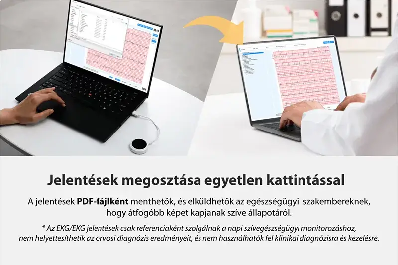 viatom-lepod-pro-er3-12-elvezeteses-24-oras-mini-ekg-holter-monitor-jelentesek